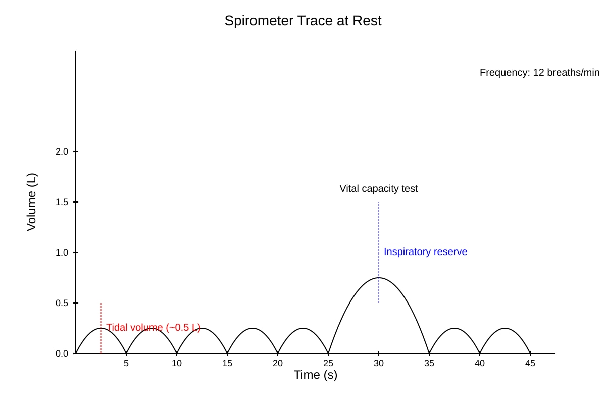 Graph for Q13 (ALEVEL Biology H2)