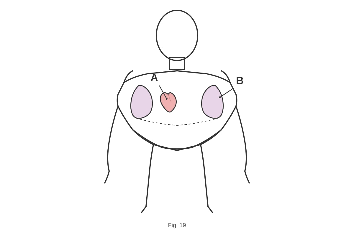 Diagram for Q19 (P3 Science)